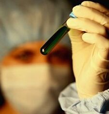 πώς να κάνετε εξετάσεις για παράσιτα